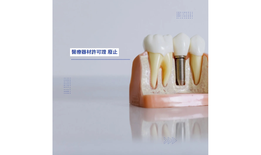 轉知 醫療器材許可證(衛部醫器製壹字第007688號)回收